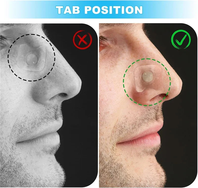 Magnetic Nasal Breathing Dilators Kits Sport