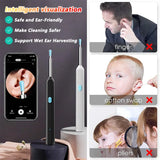Earwax Removal Endoscope with 5M Camera Luminous Otoscope