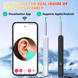 Earwax Removal Endoscope with 5M Camera Luminous Otoscope